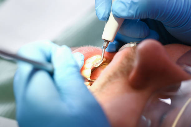 Best Emergency Orthodontic Repairs in Allison, IA